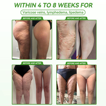 🇦🇺Official Website Direct Sales|🍀🍀 𝐋𝙀𝑹𝐂𝗘𝗔® 𝑮𝗟𝐏-𝟏 𝐌𝐞𝐭𝐚𝐛𝐨𝐥𝐢𝐜 𝐁𝐚𝐥𝐚𝐧𝐜𝐞 𝐎𝐫𝐚𝐥 𝐀𝐦𝐩𝐨𝐮𝐥𝐞: 𝐒𝐮𝐢𝐭𝐚𝐛𝐥𝐞 𝐟𝐨𝐫 𝐨𝐛𝐞𝐬𝐢𝐭𝐲, 𝐜𝐚𝐫𝐝𝐢𝐨𝐯𝐚𝐬𝐜𝐮𝐥𝐚𝐫 𝐝𝐢𝐬𝐞𝐚𝐬𝐞, 𝐝𝐢𝐚𝐛𝐞𝐭𝐞𝐬, 𝐬𝐥𝐞𝐞𝐩 𝐚𝐩𝐧𝐞𝐚 𝐬𝐲𝐧𝐝𝐫𝐨𝐦𝐞, 𝐣𝐨𝐢𝐧𝐭 𝐩𝐫𝐨𝐛𝐥𝐞𝐦𝐬, 𝐞𝐭𝐜🔥