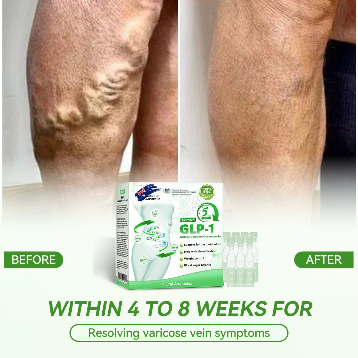 🇦🇺Official Website Direct Sales|🍀🍀 𝐋𝙀𝑹𝐂𝗘𝗔® 𝑮𝗟𝐏-𝟏 𝐌𝐞𝐭𝐚𝐛𝐨𝐥𝐢𝐜 𝐁𝐚𝐥𝐚𝐧𝐜𝐞 𝐎𝐫𝐚𝐥 𝐀𝐦𝐩𝐨𝐮𝐥𝐞: 𝐒𝐮𝐢𝐭𝐚𝐛𝐥𝐞 𝐟𝐨𝐫 𝐨𝐛𝐞𝐬𝐢𝐭𝐲, 𝐜𝐚𝐫𝐝𝐢𝐨𝐯𝐚𝐬𝐜𝐮𝐥𝐚𝐫 𝐝𝐢𝐬𝐞𝐚𝐬𝐞, 𝐝𝐢𝐚𝐛𝐞𝐭𝐞𝐬, 𝐬𝐥𝐞𝐞𝐩 𝐚𝐩𝐧𝐞𝐚 𝐬𝐲𝐧𝐝𝐫𝐨𝐦𝐞, 𝐣𝐨𝐢𝐧𝐭 𝐩𝐫𝐨𝐛𝐥𝐞𝐦𝐬, 𝐞𝐭𝐜🔥